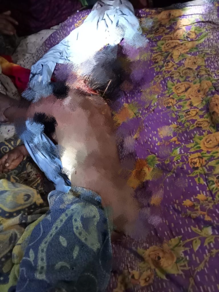 महाराजगंज : जंगल से भटकर गाव में पहुचा चीता के हमले से नन्हे बच्चे का हुआ मौत।